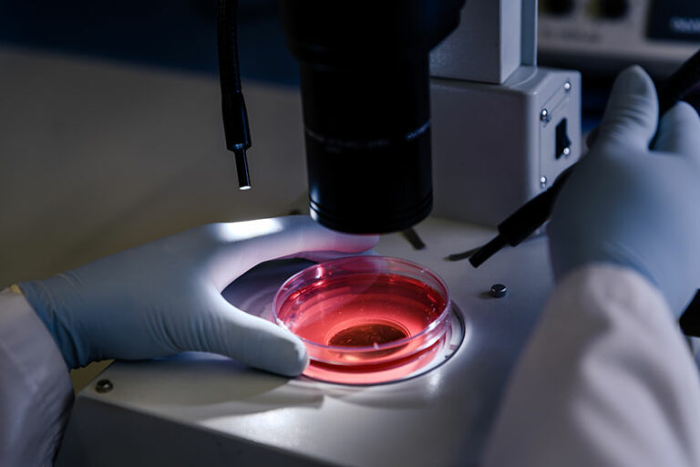 rischio biologico escherichia