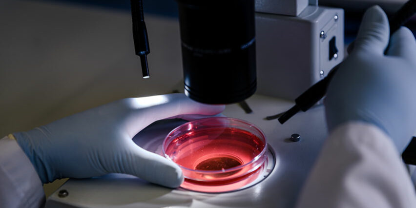 rischio biologico escherichia